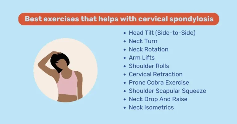 Top Recommended Exercises and Stretches to Prevent Cervical Spondylosis